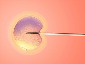 Can You Still Have IVF with Only One Ovary? 