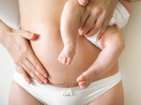 Fertility After Cesarean Section or Other Uterine Surgery Fertility After Cesarean Section or Other Uterine Surgery