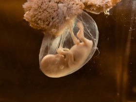 What Happens If Your Embryo Transfer Is Delayed?  
