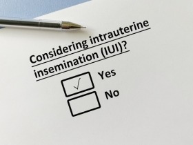 Ovulation Induction and IUI